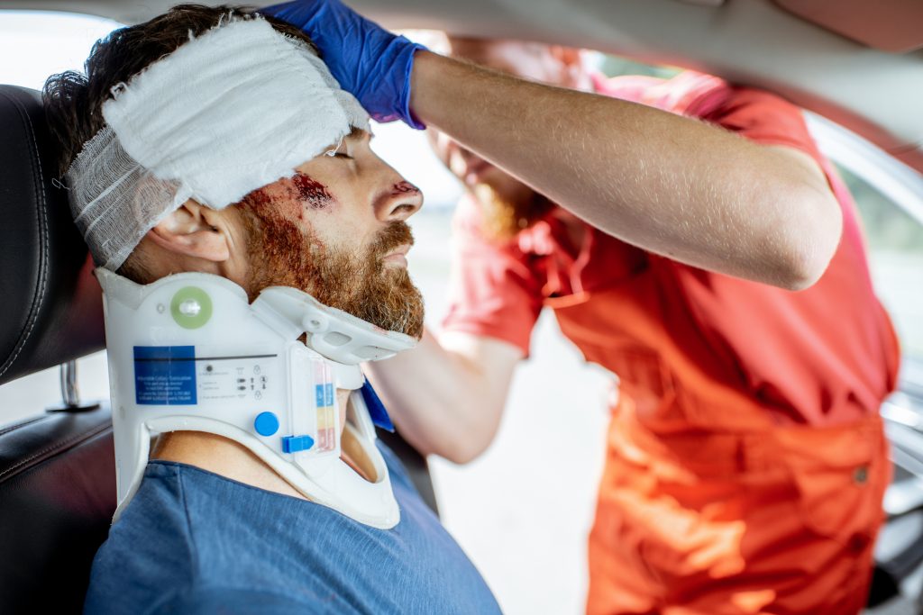 Orange county brain injury attorney 